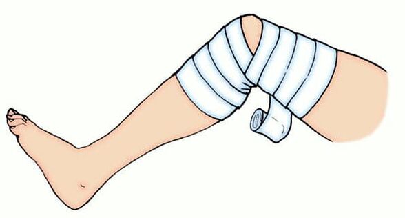 Elastic bandage